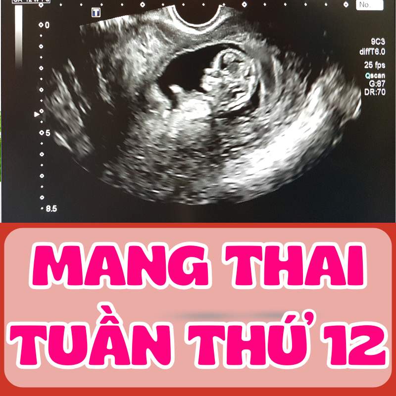 siêu âm khi mang thai tuần thứ 12